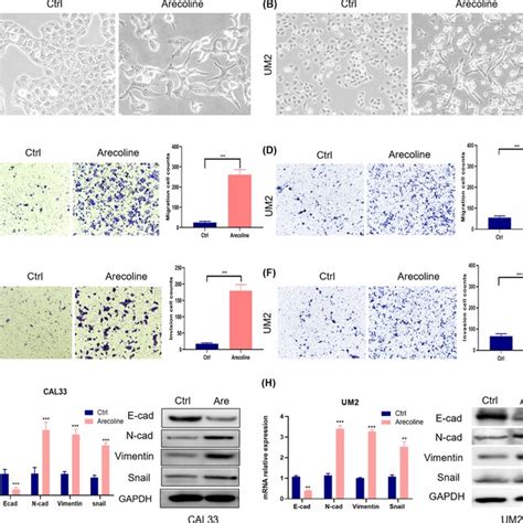 Arecolineinduced EMT And Enhanced Migration And Invasion Of OSCC