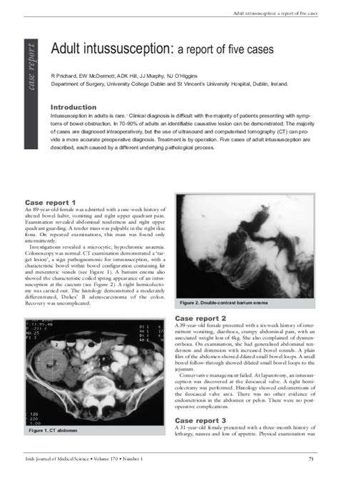 Pdf Adult Intussusception A Report Of Five Cases Enda Mcdermott