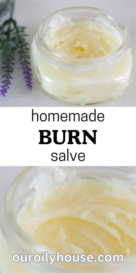 Homemade Burn Salve Salve Recipes Homemade Homemade Remedies