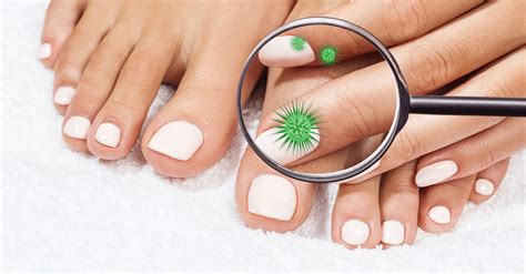 Understanding Toenail Fungus | Causes & Prevention Tips