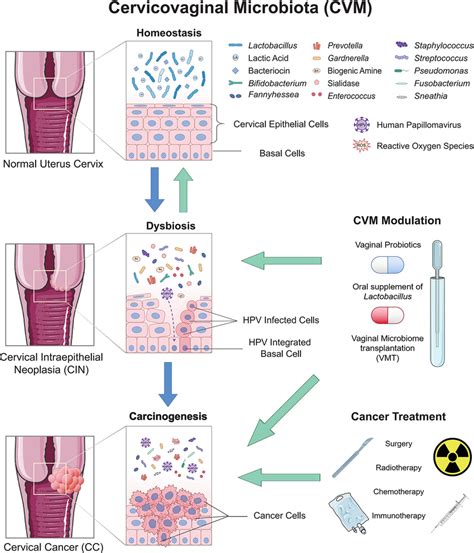 The Role Of Cervicovaginal Microbiota Cvm In Cervical Cancer Cc