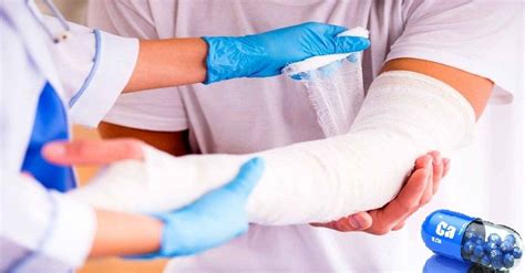 Co je pravou příčinou řídnutí kostí? Přečtěte si, že osteoporózu či ...