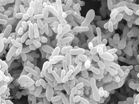 Gardnerella vaginalis