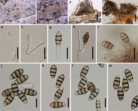 Seimatosporium Sorbi Facesoffungi Number Fof Faces Of Fungi