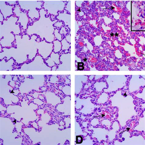 Representative Light Photomicrographs Of Lung Tissues In Experimental