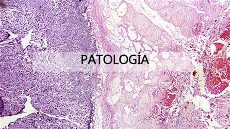O Que Patologia Clinica - QUE ES PATOLOGIA