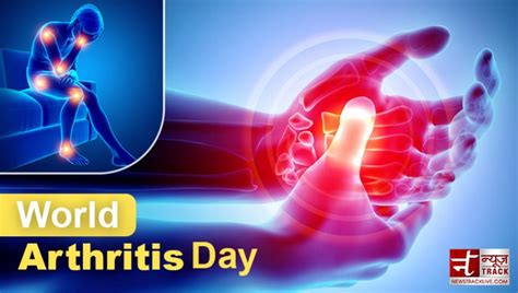 World Arthritis Day 12 October 2023 Know Its Importance And History Newstrack English 1