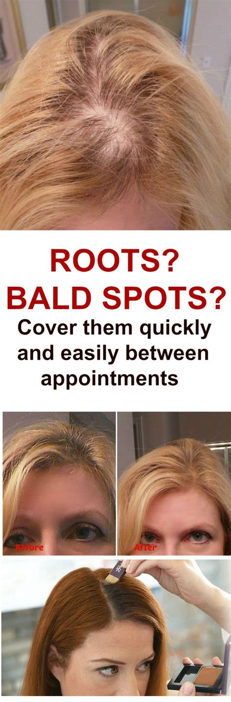 How To Cover Bald Spot With Makeup Mugeek Vidalondon