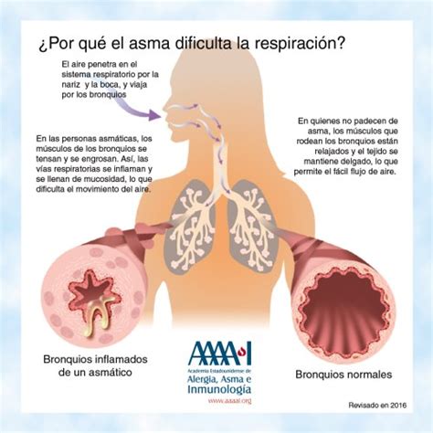 Qué es el examen de FeNO AAAAI