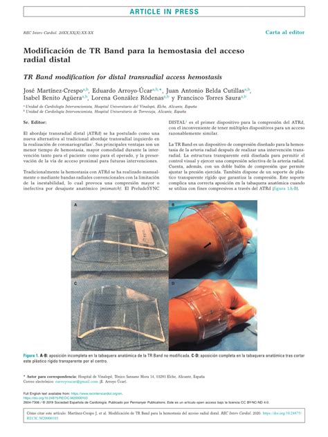 Pdf Modificaci N De Tr Band Para La Hemostasia Del Acceso Radial Distal