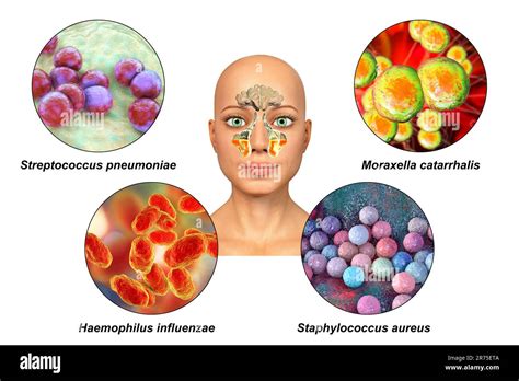 Fotos De Las Bacterias Que Causan Hot Sex Picture