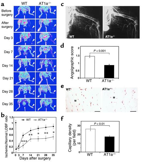 Jci Evidence For The Importance Of Angiotensin Ii Type Receptor In