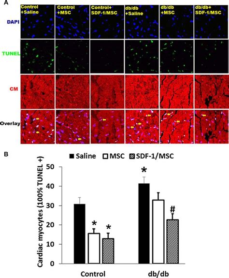 Tunel Assay For Assessment Of Cell Apoptosis A Confocal Image Of Free