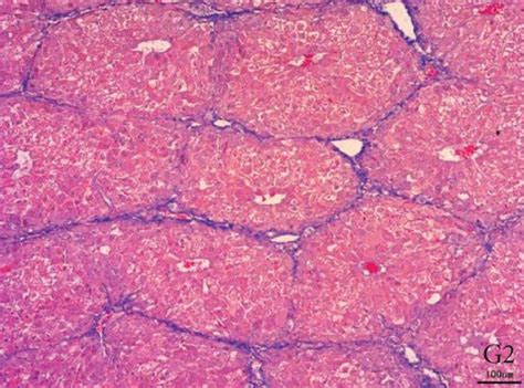 Photomicrograph Of A Liver Stained With Mt Stain ×100 The Control Download Scientific