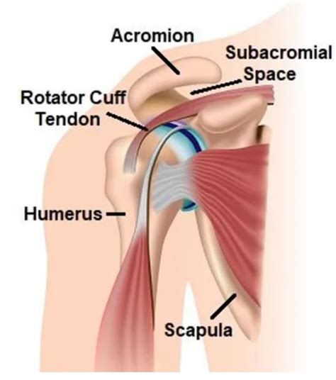 Shoulder Impingement Causes And Treatment Dubai Healthcare City