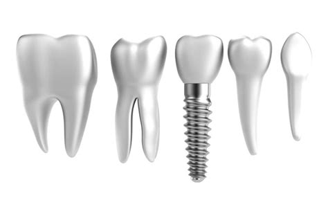 What is implantology and dental implants? | Bücco