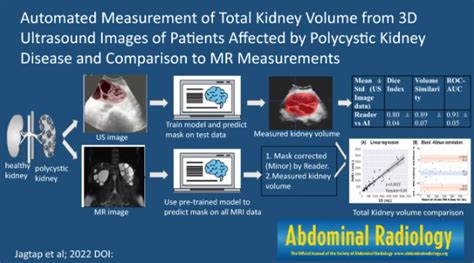 Society Of Abdominal Radiology Sar On Twitter Rt Abdominal Rad