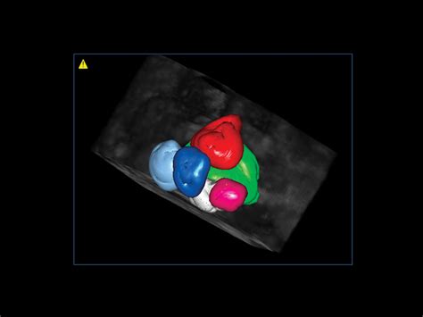 Gynaecology Ultrasound Clinical Solutions - Esaote