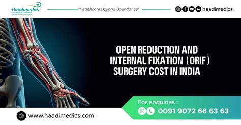 Open Reduction Internal Fixation Orif Surgery Cost In India