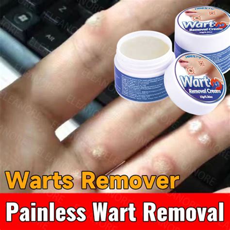 Wart removal original cream Painless Removal Wart warts removal ...