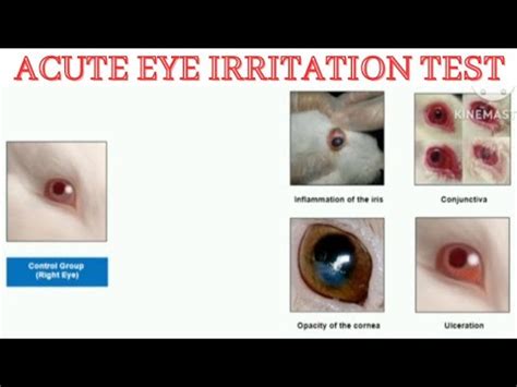 Acute Eye Irritation Test Eye Irritation Test Irritation Test YouTube