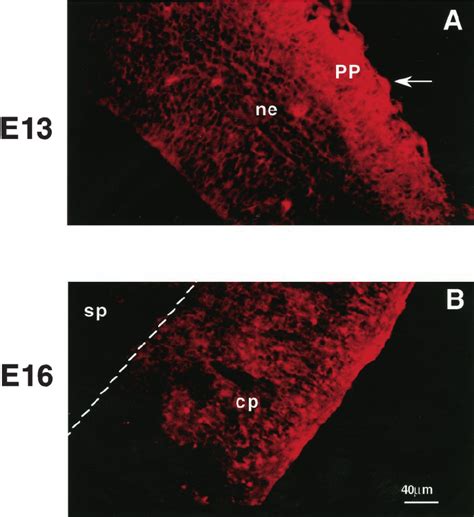 Glutamate Immunoreactivity In The Embryonic Murine Cortex Photomicro