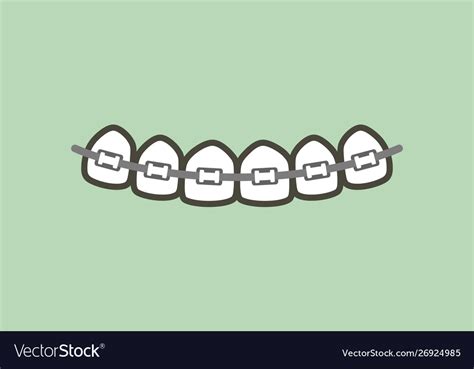 Orthodontics Teeth Or Dental Braces Royalty Free Vector