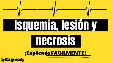 Isquemia Lesi N Y Necrosis Mioc Rdica Electrocardiograma Youtube