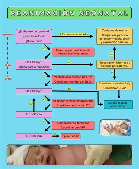 Reanimaci N Neonatal Diagrama De Flujo Javier Rios Udocz