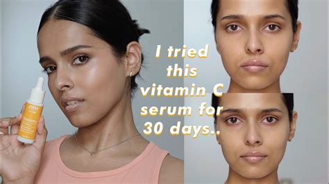 I Tried Nykaa Skinrx 10 Vitamin C Serum For 30 Days Youtube