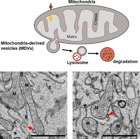 Schematic Model And Electron Microscopic Image Of Mitochondrial Derived