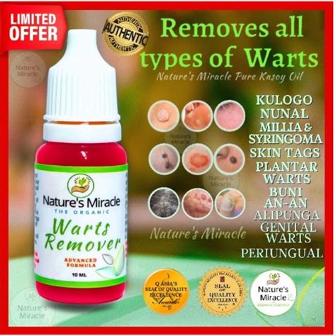 Effective Remover Of Warts And Mole Herbal Oil Natures Miracle