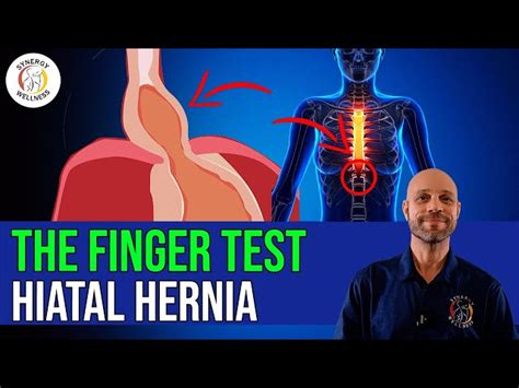 Best Hiatal Hernia Exercises Off