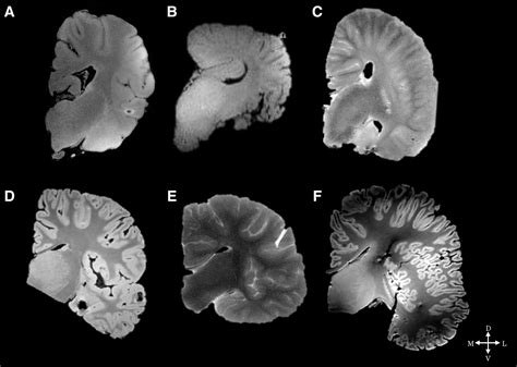 A Comparison of the Cortical Structure of the Bowhead Whale (Balaena mysticetus), a Basal ...