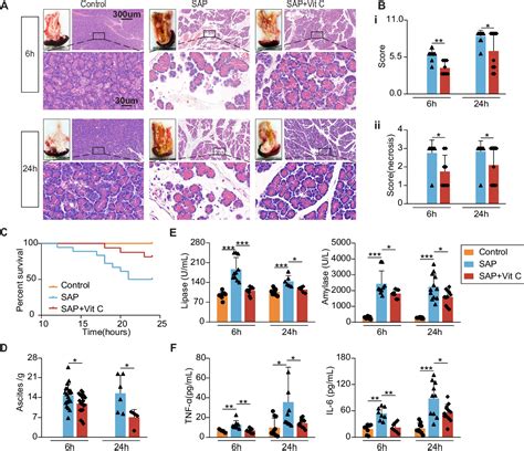 Figure 1 From High Dose Vitamin C Alleviates Pancreatic Necrosis By