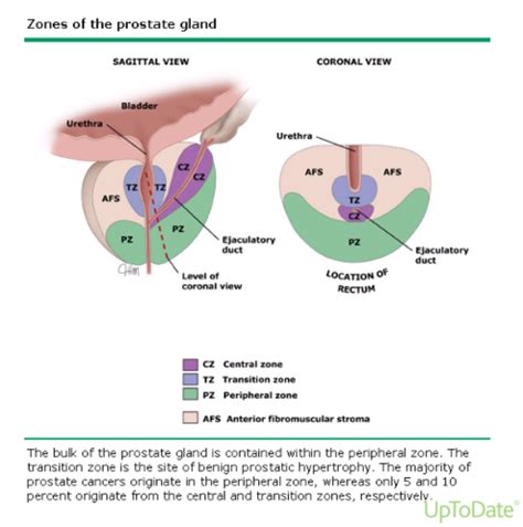 Prostate Disorders Flashcards Quizlet