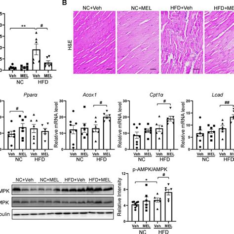 Melatonin Increases Fatty Acid Oxidation In Skeletal Muscle A Muscle Tg