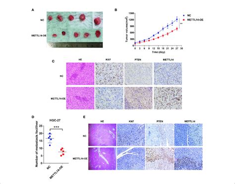 Mettl Inhibits Stad Growth And Metastasis In Vivo A The