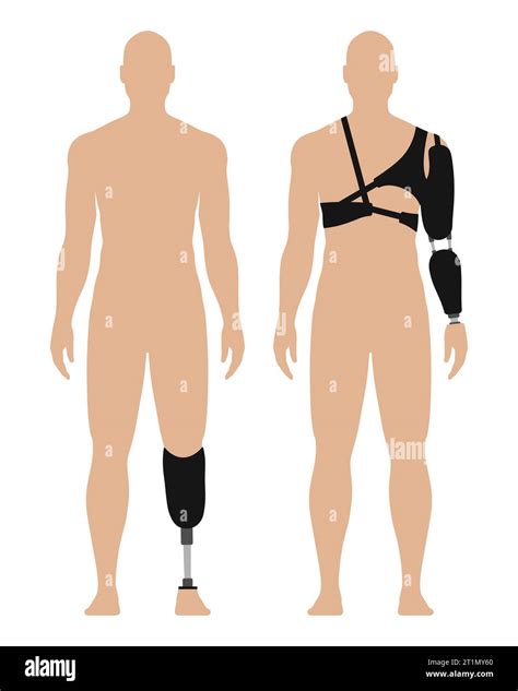 Man With Prosthetic Arm And Leg Medical Vector Illustration Set