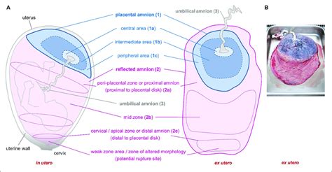 Sub Regions Of The Human Amniotic Membrane Schematic Of Placenta And Download Scientific