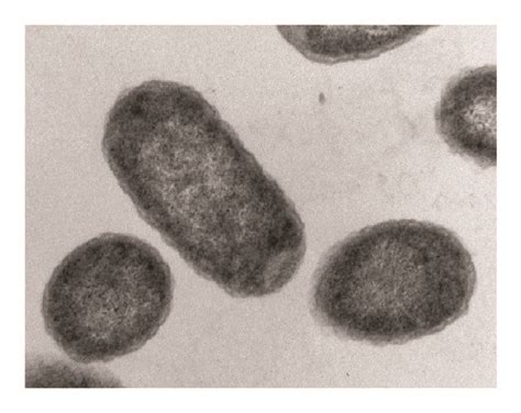 Transmission Electron Micrographs Of Ultrathin Sections Of E Coli Download Scientific Diagram