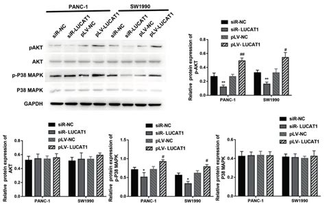 Lucat Benefits To Akt And Mapk Signaling Pathways In Pancreatic Cancer