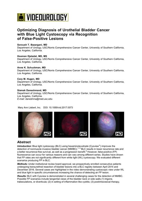 PDF Optimizing Diagnosis Of Urothelial Bladder Cancer With Blue Light