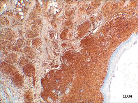 Microscopia Ptica Estudio Inmunohistoqu Mico Cd Se Observa