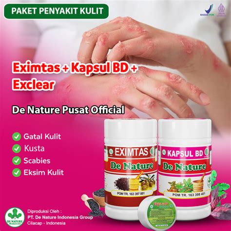 Jual Obat Penyakit Kulit Kusta Kering Basah Untuk Pria Dan Wanita