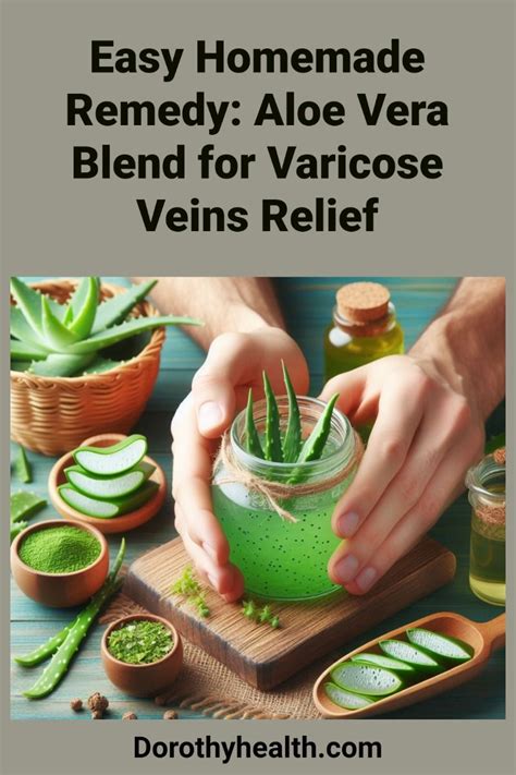 Varicose Vein Solution Artofit