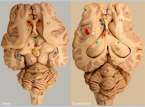 Dorsal Features Transverse Cut Of Sheep Brain Diagram Quizlet