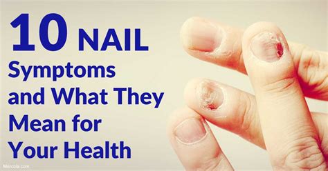 10 Nail Symptoms and What They Mean for Your Health