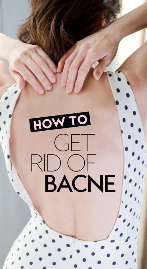 How To Get Rid Of Bacne For Good Bacne Back Acne Treatment How To Get Rid Of Acne