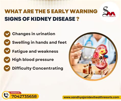 Signs Of Kidney Disease Sandhya Jani Devi Health Resort